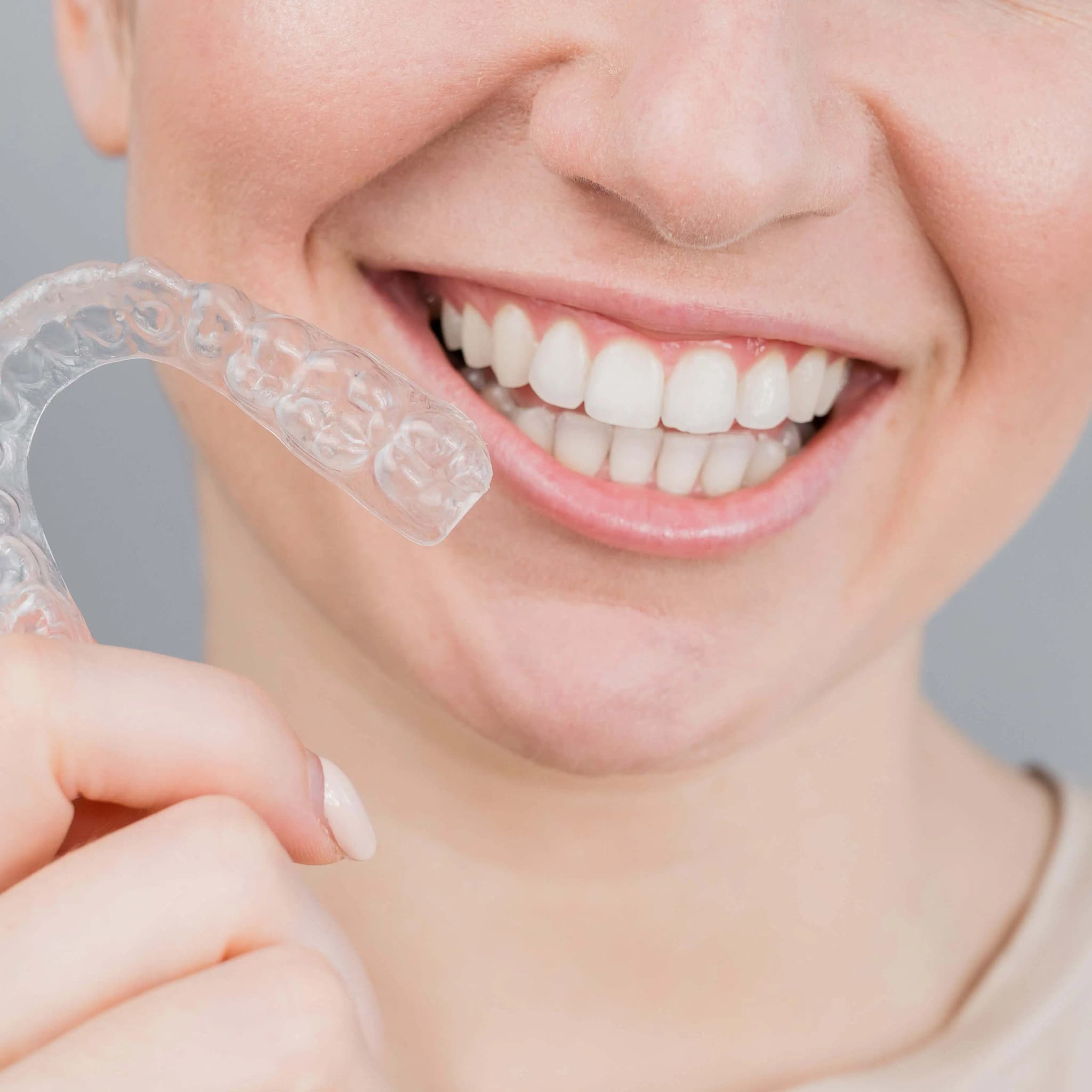 aligners